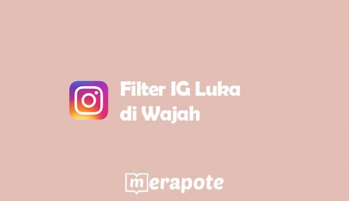 Id ig